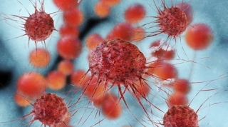 Eκθεση ΣΟΚ Αμερικανού Γενετιστή: Θέμα κακής τύχης ο καρκίνος;