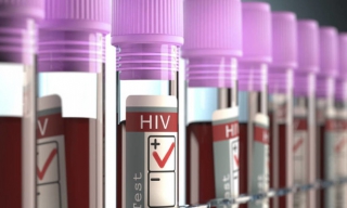 AIDS: Πρωτοφανή αποτελέσματα από νέα θεραπεία – Η περίπτωση 44χρονου Βρετανού